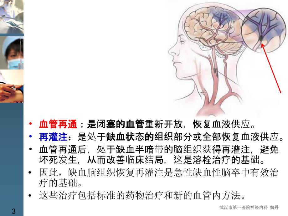 急性缺血性脑卒中取栓治疗技术.ppt_第3页