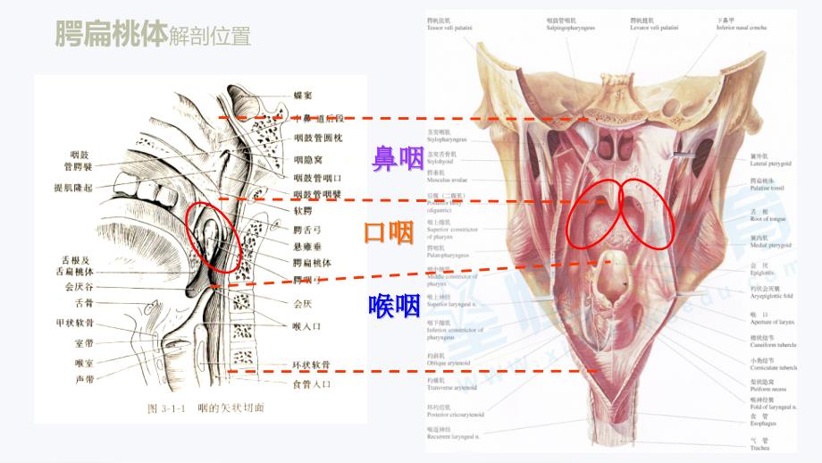 扁桃体解剖和疾病.ppt_第2页