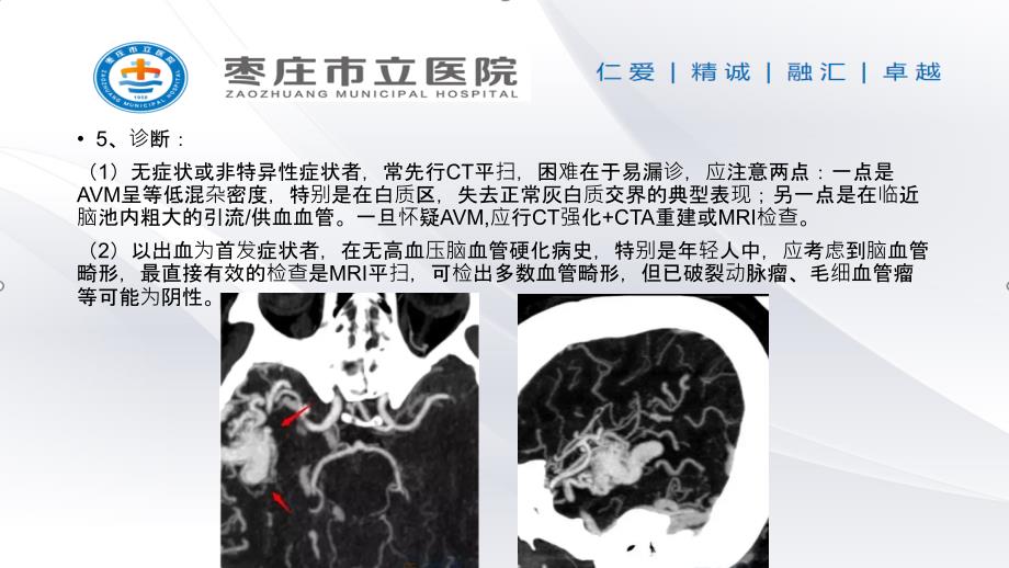常见脑血管畸形的影像学表现.pptx_第3页