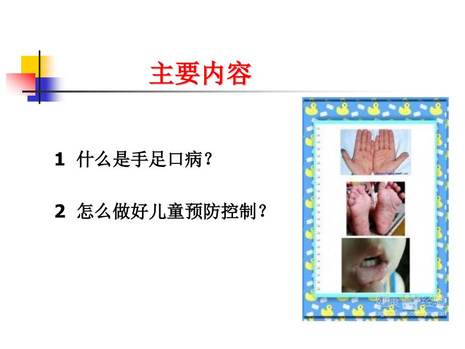 手足口病培训课件ppt.ppt_第2页