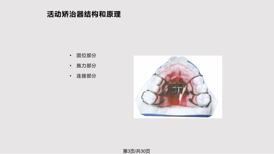 活动矫治器PPT课件.pptx_第3页