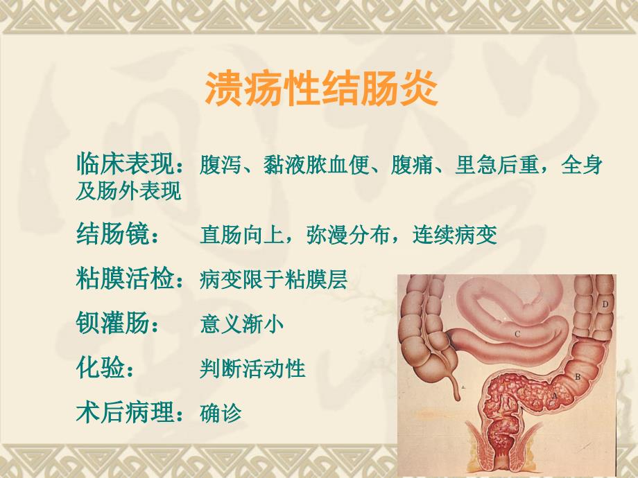 溃疡性结肠炎诊治指南课件.ppt_第3页