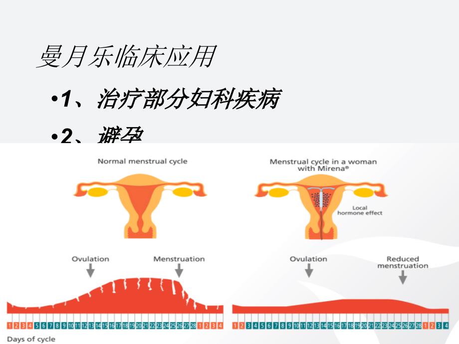 曼月乐临床应用PPT演示课件.ppt_第2页
