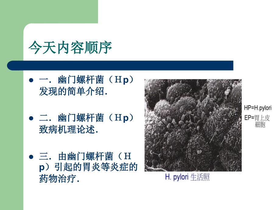幽门螺杆菌与胃癌的关系和研究.ppt_第2页