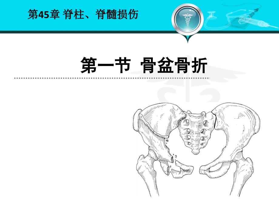 教科书骨盆髋臼骨折.ppt_第3页