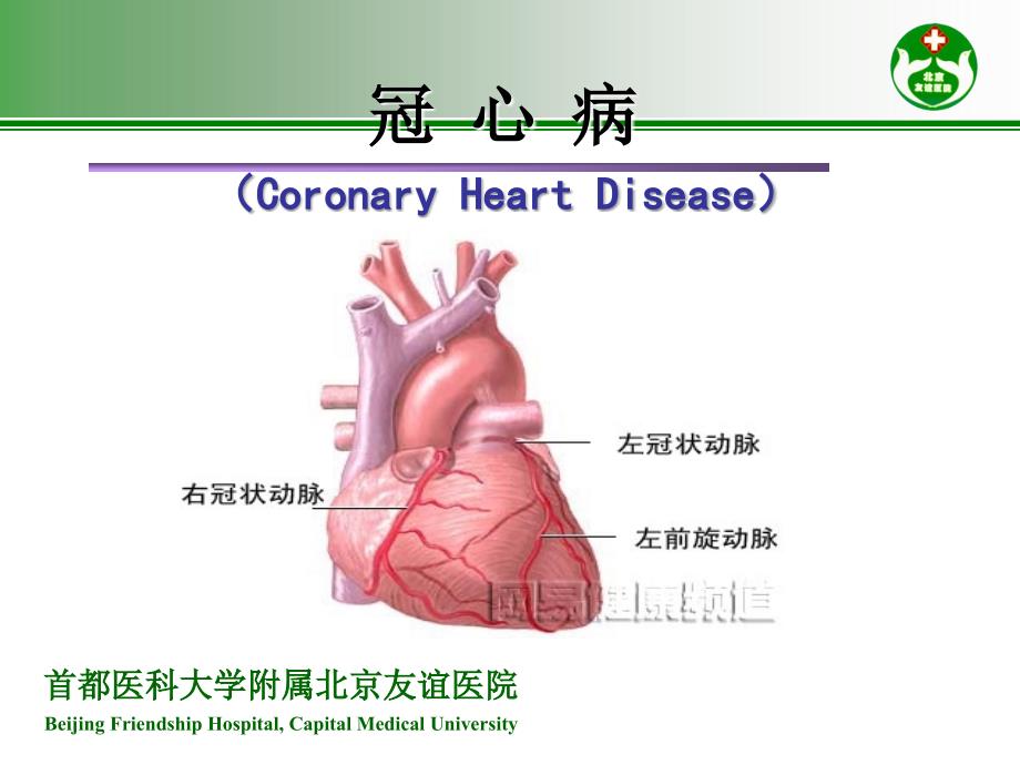 心绞痛与急性心肌梗死的识别.ppt_第3页