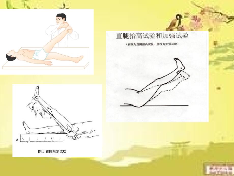 直腿抬高试验PPT课件.ppt_第3页