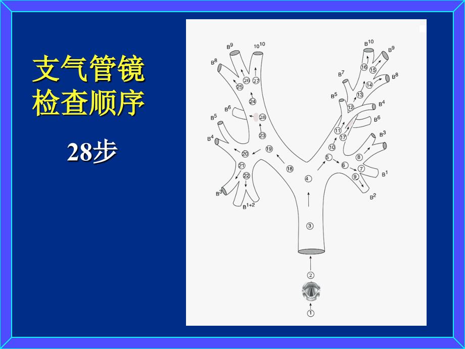 支气管镜检查的顺序及正常支气管的镜下所见课件.ppt_第2页
