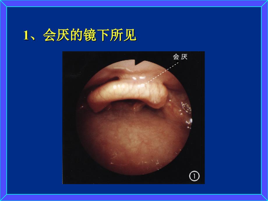 支气管镜检查的顺序及正常支气管的镜下所见课件.ppt_第3页