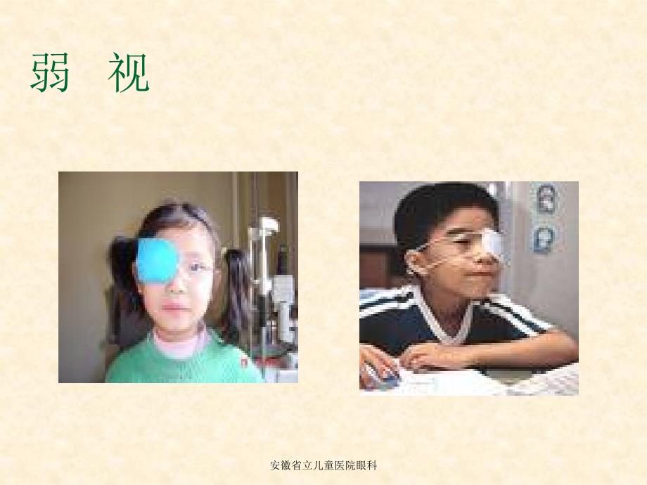 弱视PPT医学课件.ppt_第2页