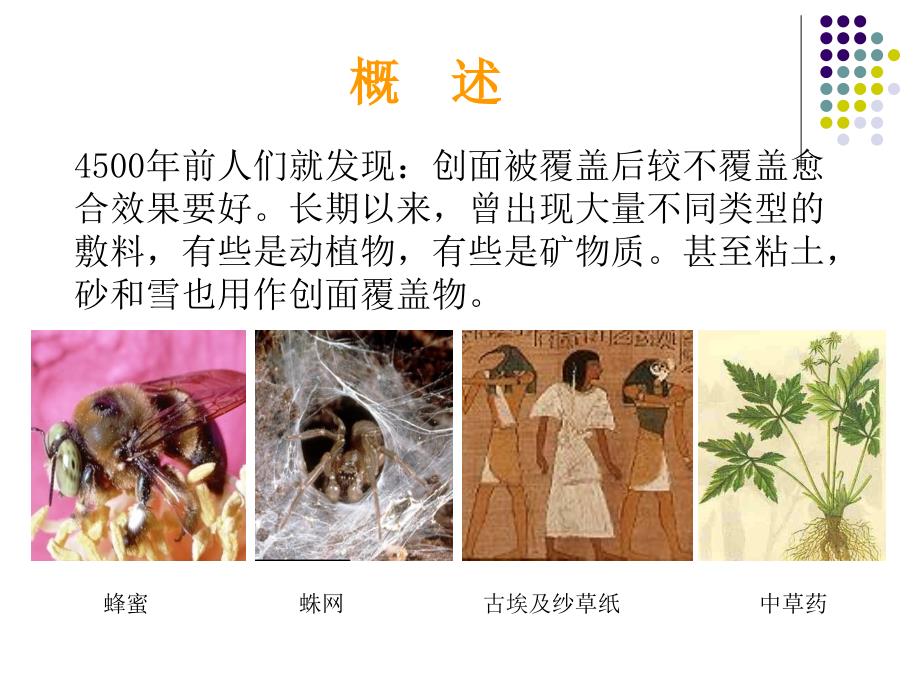 敷料的分类与选择.ppt_第3页