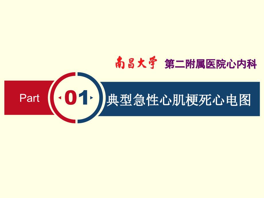 急性心肌梗死不典型心电图.ppt_第3页