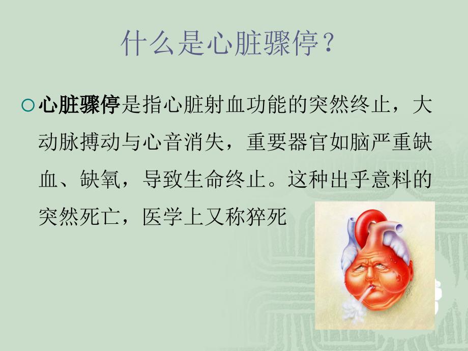 术中心脏骤停应急预案.ppt_第2页