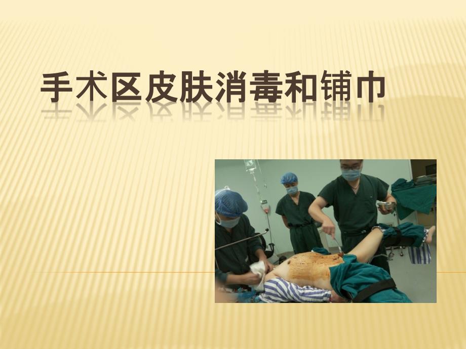 手术区皮肤的消毒和铺巾.ppt_第1页
