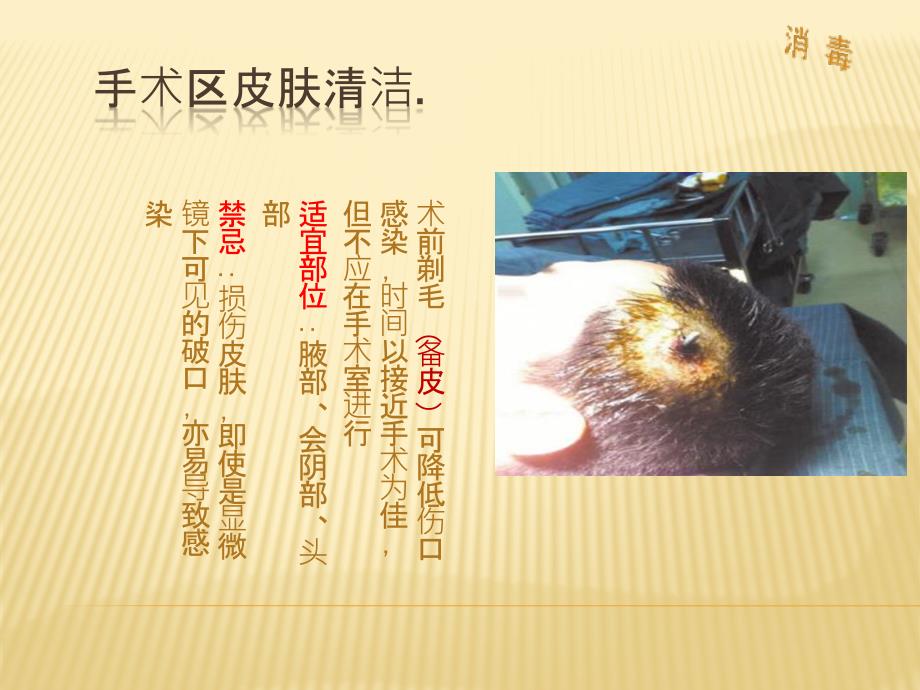 手术区皮肤的消毒和铺巾.ppt_第3页