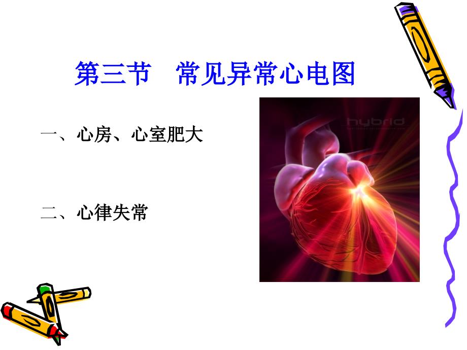 常见异常心电图PPT课件.ppt_第2页
