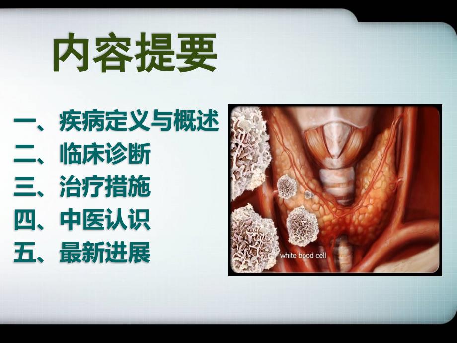 桥本氏甲状腺炎PPT课件.pptx_第2页