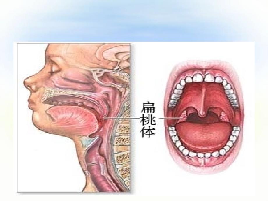 扁桃体手术配合ppt课件.ppt_第3页
