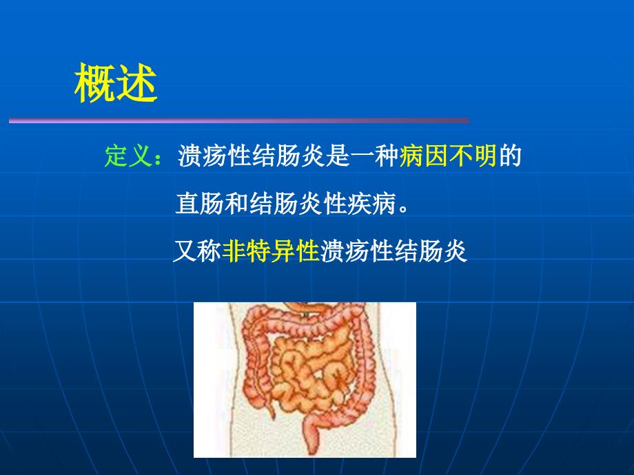 溃疡性结肠炎PPT课件.ppt_第3页