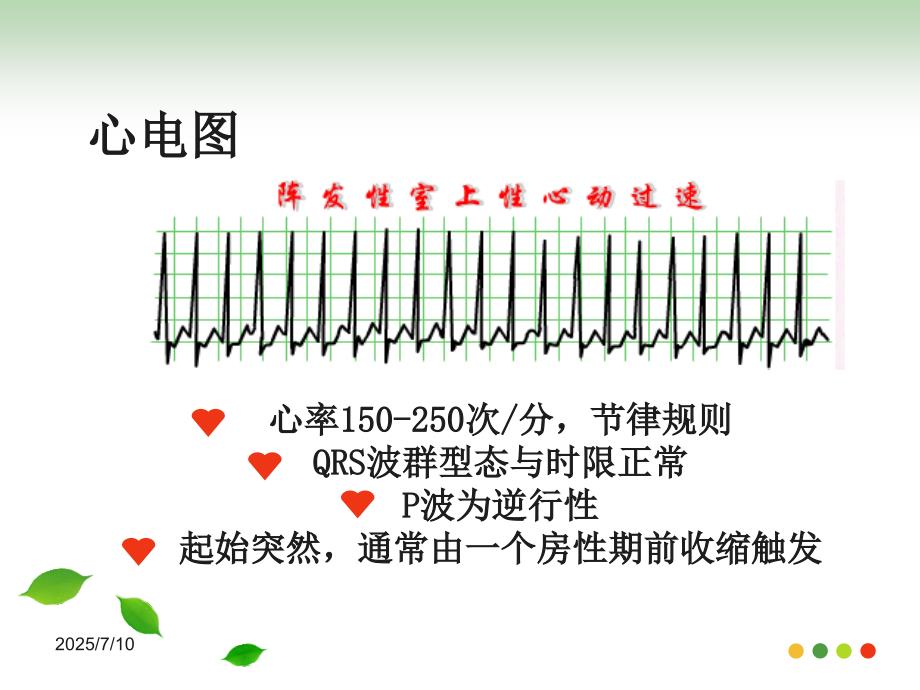 心内科护理查房阵发性室上性心动过速.ppt_第3页