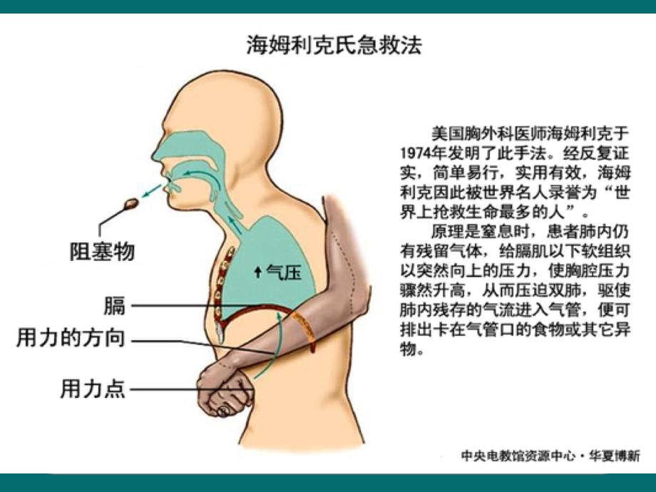海姆立克急救法ppt课件.ppt_第2页