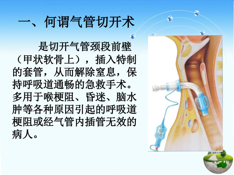 气管切开护理PPT课件.ppt_第2页