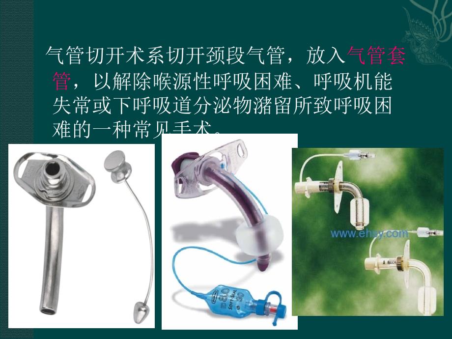 气管切开术.ppt.ppt_第2页