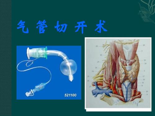 气管切开术.ppt.ppt