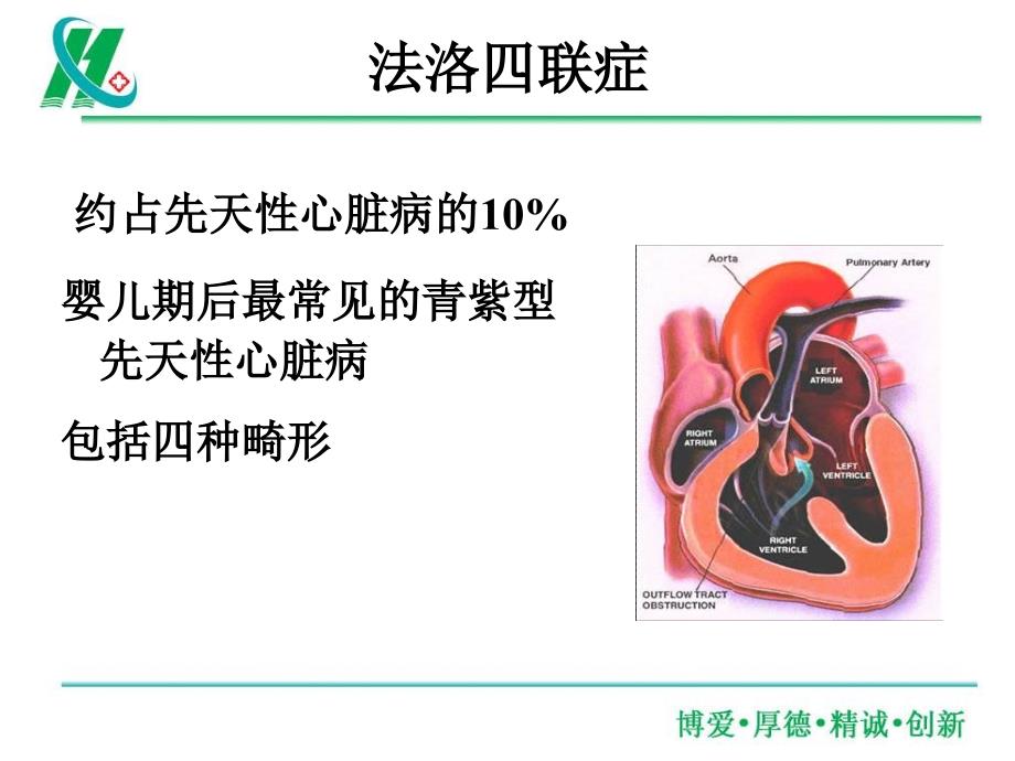 法洛四联症图文详解.ppt_第3页