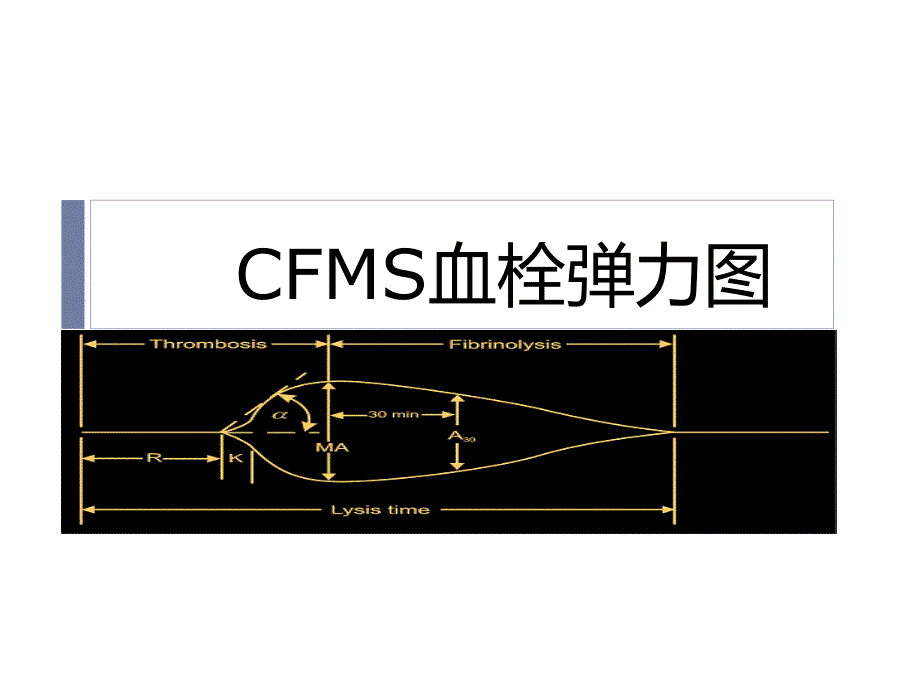 教你如何看血栓弹力图.ppt_第1页