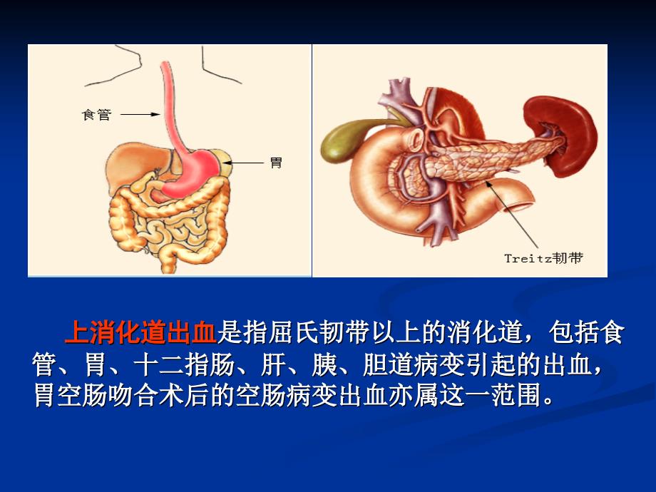 消化道出血护理查房ppt课件.ppt_第3页