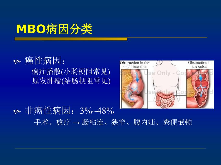 恶性肠梗阻PPT课件.ppt_第3页