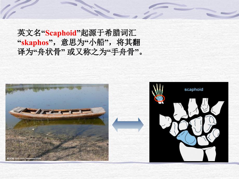 手舟骨骨折PPT课件.ppt_第3页