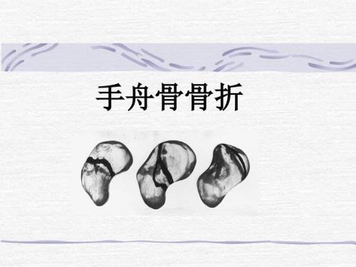 手舟骨骨折PPT课件.ppt