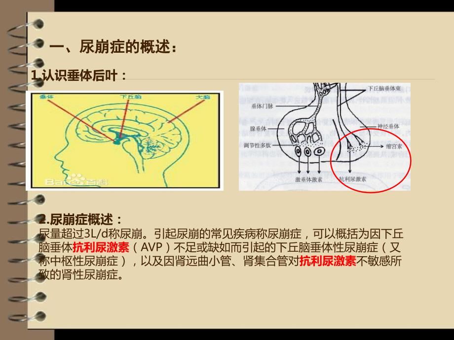 尿崩症护理查房.ppt_第3页