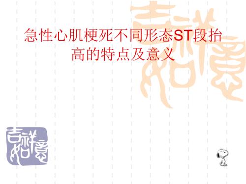 急性心肌梗死不同形态ST段抬高的特点及意义.ppt