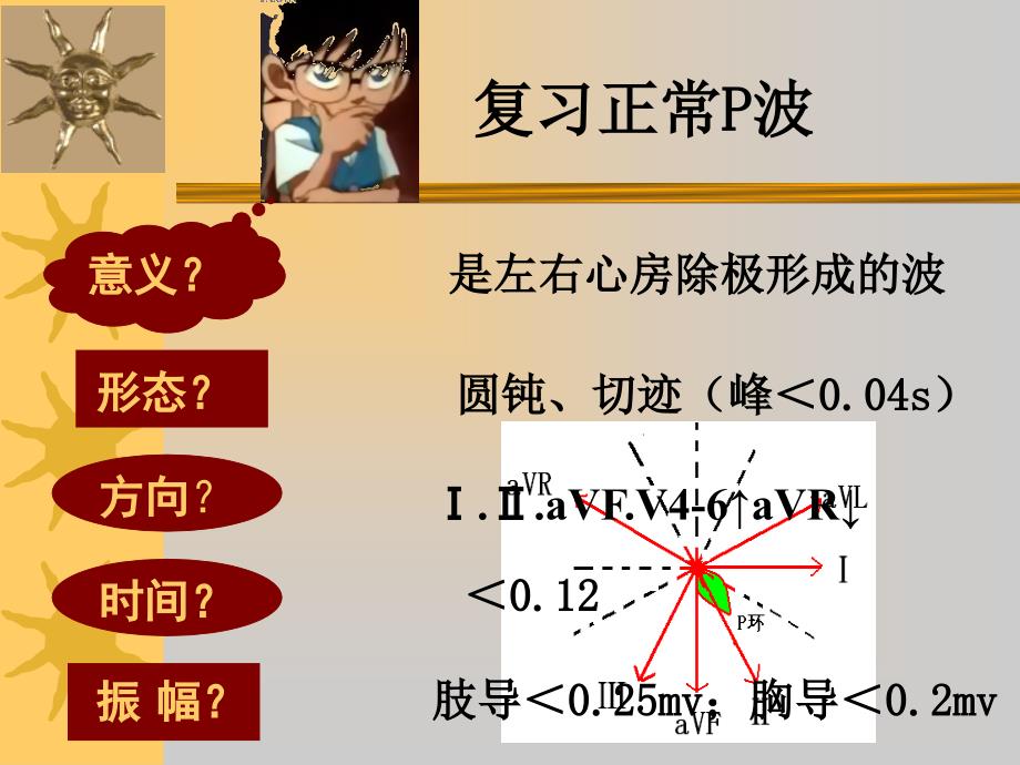 心房室肥大PPT课件.ppt_第3页