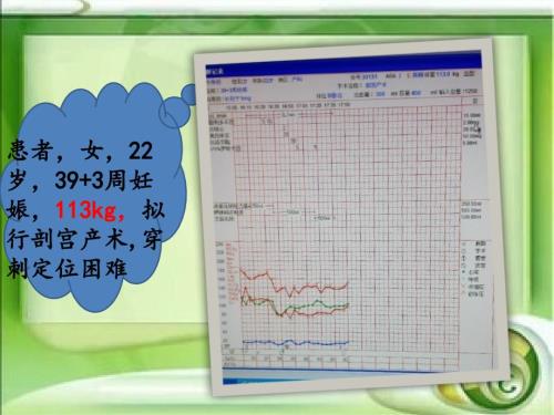 浅谈肥胖患者的麻醉处理.pptx