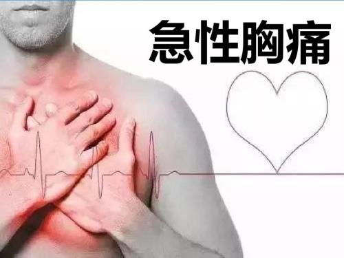 急性胸痛PPT课件.pptx