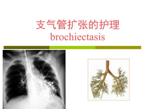 支气管扩张的护理ppt课件.ppt