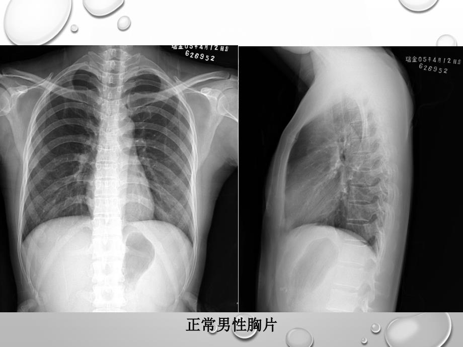 放射科阅片基础PPT课件.ppt_第2页