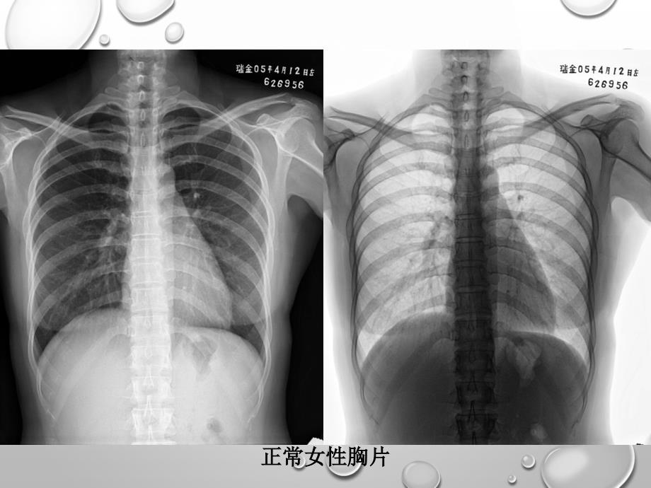 放射科阅片基础PPT课件.ppt_第3页