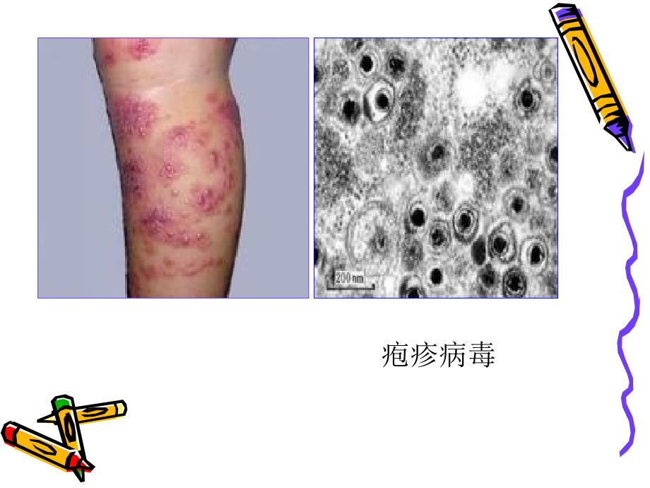 微生物的危害PPT课件.ppt_第3页