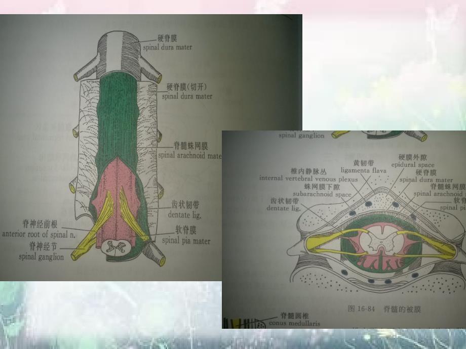 椎管内占位.ppt_第3页