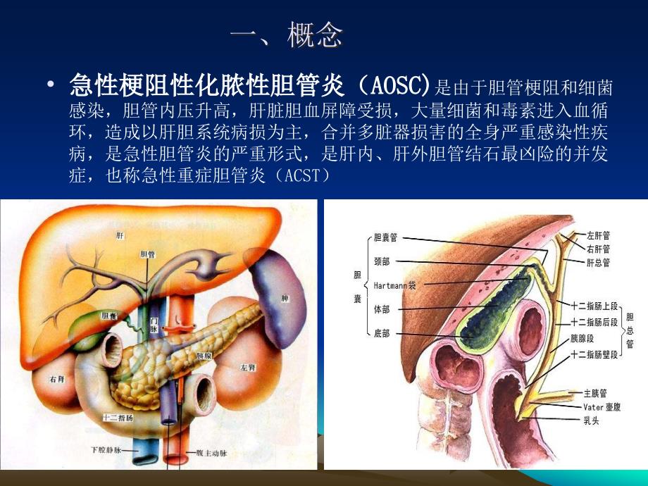 急性梗阻性化脓性胆管炎.ppt_第2页