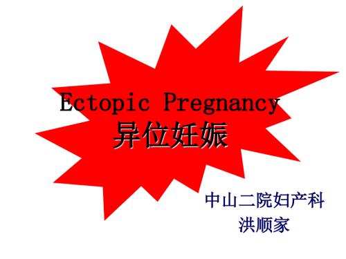 异位妊娠.ppt