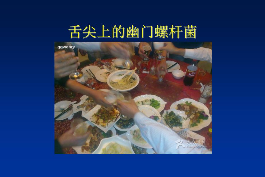 幽门螺杆菌科普PPT课件.ppt_第2页