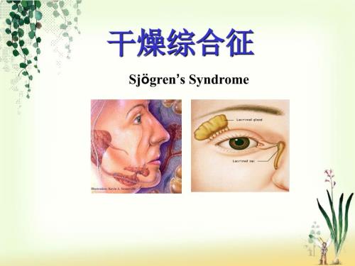 干燥综合症护理.ppt