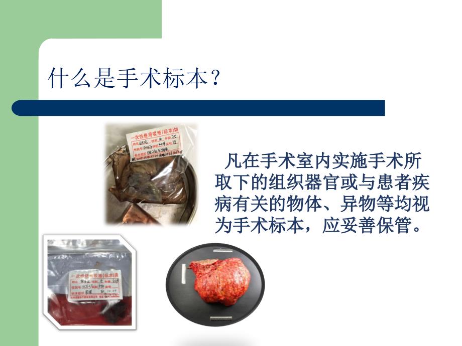 手术室标本管理PPT课件.ppt_第3页