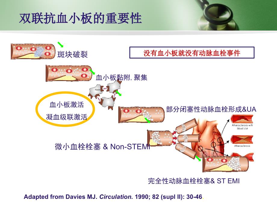 氯吡格雷与.ppt_第3页